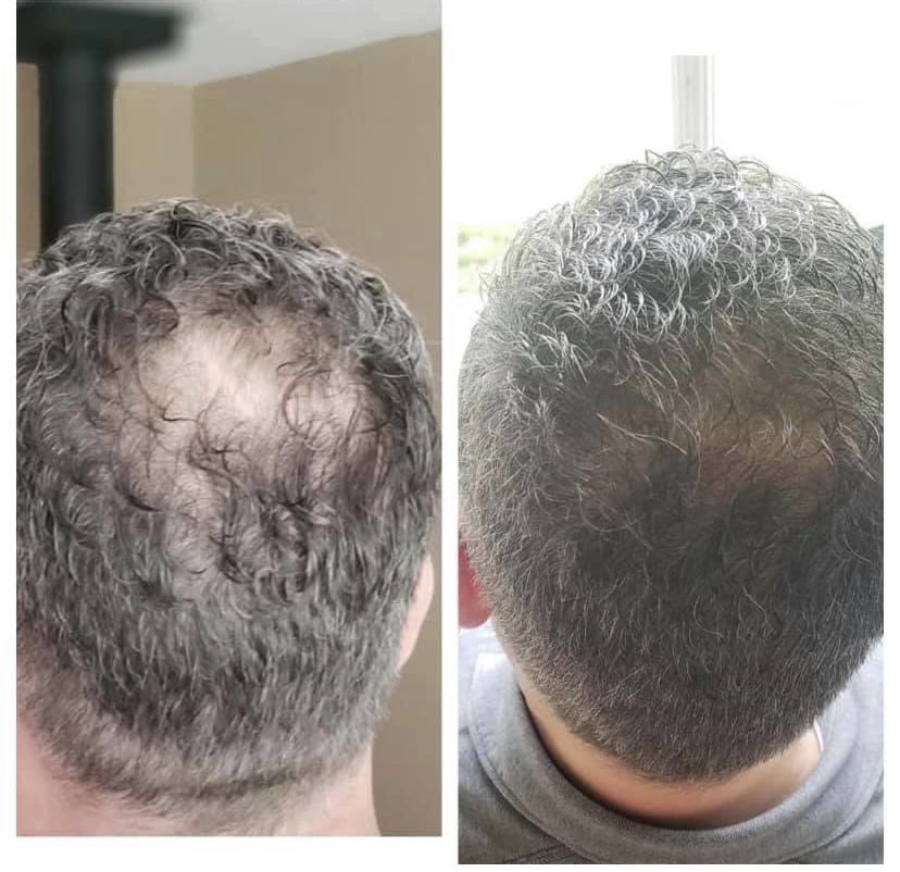شامبو شامبو جذر Hairfillup