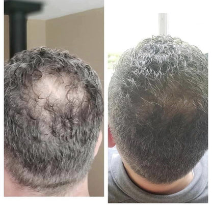 شامبو شامبو جذر Hairfillup