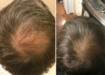 شامبو شامبو جذر Hairfillup